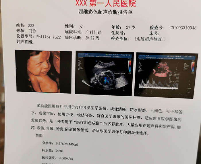 超聲膠片 超聲膠片