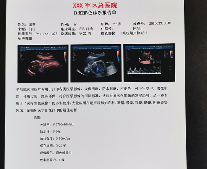 醫(yī)用超聲膠片 醫(yī)用超聲膠片