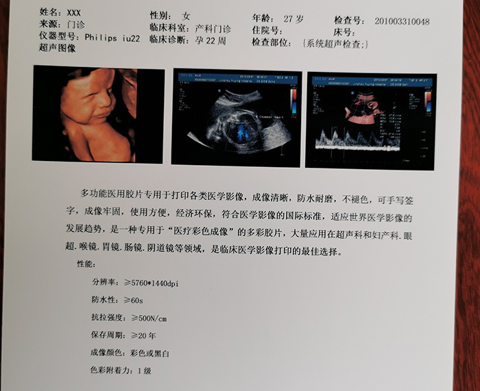 醫(yī)用干式超聲膠片 醫(yī)用干式超聲膠片