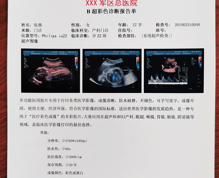 超聲彩色膠片 超聲彩色膠片